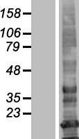 Western blot validation of overexpression lysate (Cat# LY404712) using anti-DDK antibody (Cat# TA50011-100). Left: Cell lysates from un-transfected HEK293T cells; Right: Cell lysates from HEK293T cells transfected with RC220013 using transfection reagent MegaTran 2.0 (Cat# TT210002).