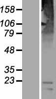 Western blot validation of overexpression lysate (Cat# LY405628) using anti-DDK antibody (Cat# TA50011-100). Left: Cell lysates from un-transfected HEK293T cells; Right: Cell lysates from HEK293T cells transfected with RC223591 using transfection reagent MegaTran 2.0 (Cat# TT210002).