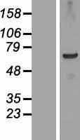 Western blot validation of overexpression lysate (Cat# LY407312) using anti-DDK antibody (Cat# TA50011-100). Left: Cell lysates from un-transfected HEK293T cells; Right: Cell lysates from HEK293T cells transfected with RC215925 using transfection reagent MegaTran 2.0 (Cat# TT210002).