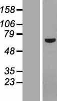 Western blot validation of overexpression lysate (Cat# LY407576) using anti-DDK antibody (Cat# TA50011-100). Left: Cell lysates from un-transfected HEK293T cells; Right: Cell lysates from HEK293T cells transfected with RC211731 using transfection reagent MegaTran 2.0 (Cat# TT210002).