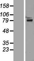 Western blot validation of overexpression lysate (Cat# LY411159) using anti-DDK antibody (Cat# TA50011-100). Left: Cell lysates from un-transfected HEK293T cells; Right: Cell lysates from HEK293T cells transfected with RC218356 using transfection reagent MegaTran 2.0 (Cat# TT210002).
