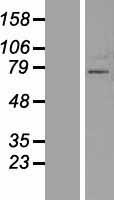 Western blot validation of overexpression lysate (Cat# LY406050) using anti-DDK antibody (Cat# TA50011-100). Left: Cell lysates from un-transfected HEK293T cells; Right: Cell lysates from HEK293T cells transfected with RC224078 using transfection reagent MegaTran 2.0 (Cat# TT210002).