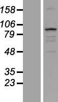 Western blot validation of overexpression lysate (Cat# LY407159) using anti-DDK antibody (Cat# TA50011-100). Left: Cell lysates from un-transfected HEK293T cells; Right: Cell lysates from HEK293T cells transfected with RC222940 using transfection reagent MegaTran 2.0 (Cat# TT210002).