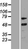 Western blot validation of overexpression lysate (Cat# LY420056) using anti-DDK antibody (Cat# TA50011-100). Left: Cell lysates from un-transfected HEK293T cells; Right: Cell lysates from HEK293T cells transfected with RC216893 using transfection reagent MegaTran 2.0 (Cat# TT210002).