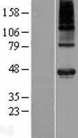 Western blot validation of overexpression lysate (Cat# LY414586) using anti-DDK antibody (Cat# TA50011-100). Left: Cell lysates from un-transfected HEK293T cells; Right: Cell lysates from HEK293T cells transfected with RC222704 using transfection reagent MegaTran 2.0 (Cat# TT210002).