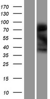 Western blot validation of overexpression lysate (Cat# LY404998) using anti-DDK antibody (Cat# TA50011-100). Left: Cell lysates from un-transfected HEK293T cells; Right: Cell lysates from HEK293T cells transfected with RC223251 using transfection reagent MegaTran 2.0 (Cat# TT210002).