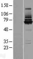 Western blot validation of overexpression lysate (Cat# LY410174) using anti-DDK antibody (Cat# TA50011-100). Left: Cell lysates from un-transfected HEK293T cells; Right: Cell lysates from HEK293T cells transfected with RC219727 using transfection reagent MegaTran 2.0 (Cat# TT210002).