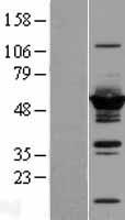 Western blot validation of overexpression lysate (Cat# LY416842) using anti-DDK antibody (Cat# TA50011-100). Left: Cell lysates from un-transfected HEK293T cells; Right: Cell lysates from HEK293T cells transfected with RC206851 using transfection reagent MegaTran 2.0 (Cat# TT210002).