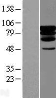Western blot validation of overexpression lysate (Cat# LY411778) using anti-DDK antibody (Cat# TA50011-100). Left: Cell lysates from un-transfected HEK293T cells; Right: Cell lysates from HEK293T cells transfected with RC203430 using transfection reagent MegaTran 2.0 (Cat# TT210002).