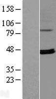 Western blot validation of overexpression lysate (Cat# LY409829) using anti-DDK antibody (Cat# TA50011-100). Left: Cell lysates from un-transfected HEK293T cells; Right: Cell lysates from HEK293T cells transfected with RC204352 using transfection reagent MegaTran 2.0 (Cat# TT210002).