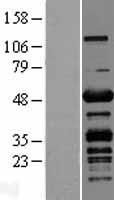 Western blot validation of overexpression lysate (Cat# LY414081) using anti-DDK antibody (Cat# TA50011-100). Left: Cell lysates from un-transfected HEK293T cells; Right: Cell lysates from HEK293T cells transfected with RC203969 using transfection reagent MegaTran 2.0 (Cat# TT210002).