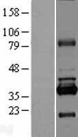 Western blot validation of overexpression lysate (Cat# LY409228) using anti-DDK antibody (Cat# TA50011-100). Left: Cell lysates from un-transfected HEK293T cells; Right: Cell lysates from HEK293T cells transfected with RC204013 using transfection reagent MegaTran 2.0 (Cat# TT210002).