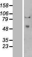 Western blot validation of overexpression lysate (Cat# LY409761) using anti-DDK antibody (Cat# TA50011-100). Left: Cell lysates from un-transfected HEK293T cells; Right: Cell lysates from HEK293T cells transfected with RC201146 using transfection reagent MegaTran 2.0 (Cat# TT210002).