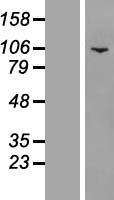 Western blot validation of overexpression lysate (Cat# LY417545) using anti-DDK antibody (Cat# TA50011-100). Left: Cell lysates from un-transfected HEK293T cells; Right: Cell lysates from HEK293T cells transfected with RC201424 using transfection reagent MegaTran 2.0 (Cat# TT210002).