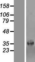 Western blot validation of overexpression lysate (Cat# LY414556) using anti-DDK antibody (Cat# TA50011-100). Left: Cell lysates from un-transfected HEK293T cells; Right: Cell lysates from HEK293T cells transfected with RC201091 using transfection reagent MegaTran 2.0 (Cat# TT210002).