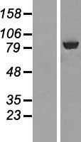Western blot validation of overexpression lysate (Cat# LY413110) using anti-DDK antibody (Cat# TA50011-100). Left: Cell lysates from un-transfected HEK293T cells; Right: Cell lysates from HEK293T cells transfected with RC201403 using transfection reagent MegaTran 2.0 (Cat# TT210002).