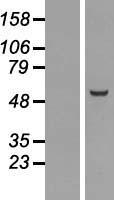 Western blot validation of overexpression lysate (Cat# LY407899) using anti-DDK antibody (Cat# TA50011-100). Left: Cell lysates from un-transfected HEK293T cells; Right: Cell lysates from HEK293T cells transfected with RC218603 using transfection reagent MegaTran 2.0 (Cat# TT210002).