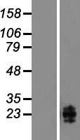 Western blot validation of overexpression lysate (Cat# LY417484) using anti-DDK antibody (Cat# TA50011-100). Left: Cell lysates from un-transfected HEK293T cells; Right: Cell lysates from HEK293T cells transfected with RC202700 using transfection reagent MegaTran 2.0 (Cat# TT210002).