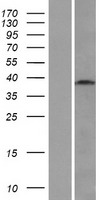 Western blot validation of overexpression lysate (Cat# LY412737) using anti-DDK antibody (Cat# TA50011-100). Left: Cell lysates from un-transfected HEK293T cells; Right: Cell lysates from HEK293T cells transfected with RC203196 using transfection reagent MegaTran 2.0 (Cat# TT210002).