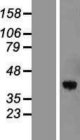 Western blot validation of overexpression lysate (Cat# LY415210) using anti-DDK antibody (Cat# TA50011-100). Left: Cell lysates from un-transfected HEK293T cells; Right: Cell lysates from HEK293T cells transfected with RC204937 using transfection reagent MegaTran 2.0 (Cat# TT210002).