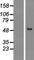 Western blot validation of overexpression lysate (Cat# LY411488) using anti-DDK antibody (Cat# TA50011-100). Left: Cell lysates from un-transfected HEK293T cells; Right: Cell lysates from HEK293T cells transfected with RC210425 using transfection reagent MegaTran 2.0 (Cat# TT210002).