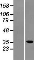 Western blot validation of overexpression lysate (Cat# LY422937) using anti-DDK antibody (Cat# TA50011-100). Left: Cell lysates from un-transfected HEK293T cells; Right: Cell lysates from HEK293T cells transfected with RC211055 using transfection reagent MegaTran 2.0 (Cat# TT210002).
