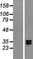 Western blot validation of overexpression lysate (Cat# LY422042) using anti-DDK antibody (Cat# TA50011-100). Left: Cell lysates from un-transfected HEK293T cells; Right: Cell lysates from HEK293T cells transfected with RC210078 using transfection reagent MegaTran 2.0 (Cat# TT210002).