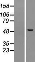 Western blot validation of overexpression lysate (Cat# LY406731) using anti-DDK antibody (Cat# TA50011-100). Left: Cell lysates from un-transfected HEK293T cells; Right: Cell lysates from HEK293T cells transfected with RC209604 using transfection reagent MegaTran 2.0 (Cat# TT210002).