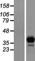 Western blot validation of overexpression lysate (Cat# LY415873) using anti-DDK antibody (Cat# TA50011-100). Left: Cell lysates from un-transfected HEK293T cells; Right: Cell lysates from HEK293T cells transfected with RC200197 using transfection reagent MegaTran 2.0 (Cat# TT210002).