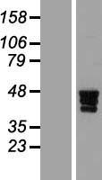 Western blot validation of overexpression lysate (Cat# LY407500) using anti-DDK antibody (Cat# TA50011-100). Left: Cell lysates from un-transfected HEK293T cells; Right: Cell lysates from HEK293T cells transfected with RC211331 using transfection reagent MegaTran 2.0 (Cat# TT210002).