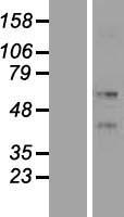 Western blot validation of overexpression lysate (Cat# LY419436) using anti-DDK antibody (Cat# TA50011-100). Left: Cell lysates from un-transfected HEK293T cells; Right: Cell lysates from HEK293T cells transfected with RC210176 using transfection reagent MegaTran 2.0 (Cat# TT210002).