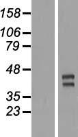 Western blot validation of overexpression lysate (Cat# LY406464) using anti-DDK antibody (Cat# TA50011-100). Left: Cell lysates from un-transfected HEK293T cells; Right: Cell lysates from HEK293T cells transfected with RC211281 using transfection reagent MegaTran 2.0 (Cat# TT210002).