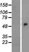Western blot validation of overexpression lysate (Cat# LY407073) using anti-DDK antibody (Cat# TA50011-100). Left: Cell lysates from un-transfected HEK293T cells; Right: Cell lysates from HEK293T cells transfected with RC211014 using transfection reagent MegaTran 2.0 (Cat# TT210002).