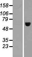 Western blot validation of overexpression lysate (Cat# LY408553) using anti-DDK antibody (Cat# TA50011-100). Left: Cell lysates from un-transfected HEK293T cells; Right: Cell lysates from HEK293T cells transfected with RC210895 using transfection reagent MegaTran 2.0 (Cat# TT210002).