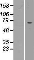 Western blot validation of overexpression lysate (Cat# LY407856) using anti-DDK antibody (Cat# TA50011-100). Left: Cell lysates from un-transfected HEK293T cells; Right: Cell lysates from HEK293T cells transfected with RC210896 using transfection reagent MegaTran 2.0 (Cat# TT210002).