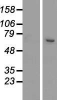Western blot validation of overexpression lysate (Cat# LY410259) using anti-DDK antibody (Cat# TA50011-100). Left: Cell lysates from un-transfected HEK293T cells; Right: Cell lysates from HEK293T cells transfected with RC214566 using transfection reagent MegaTran 2.0 (Cat# TT210002).