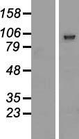 Western blot validation of overexpression lysate (Cat# LY412935) using anti-DDK antibody (Cat# TA50011-100). Left: Cell lysates from un-transfected HEK293T cells; Right: Cell lysates from HEK293T cells transfected with RC217242 using transfection reagent MegaTran 2.0 (Cat# TT210002).