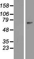 Western blot validation of overexpression lysate (Cat# LY407113) using anti-DDK antibody (Cat# TA50011-100). Left: Cell lysates from un-transfected HEK293T cells; Right: Cell lysates from HEK293T cells transfected with RC217949 using transfection reagent MegaTran 2.0 (Cat# TT210002).