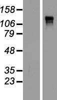 Western blot validation of overexpression lysate (Cat# LY412986) using anti-DDK antibody (Cat# TA50011-100). Left: Cell lysates from un-transfected HEK293T cells; Right: Cell lysates from HEK293T cells transfected with RC216272 using transfection reagent MegaTran 2.0 (Cat# TT210002).