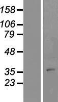 Western blot validation of overexpression lysate (Cat# LY412285) using anti-DDK antibody (Cat# TA50011-100). Left: Cell lysates from un-transfected HEK293T cells; Right: Cell lysates from HEK293T cells transfected with RC212197 using transfection reagent MegaTran 2.0 (Cat# TT210002).