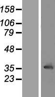 Western blot validation of overexpression lysate (Cat# LY404455) using anti-DDK antibody (Cat# TA50011-100). Left: Cell lysates from un-transfected HEK293T cells; Right: Cell lysates from HEK293T cells transfected with RC212671 using transfection reagent MegaTran 2.0 (Cat# TT210002).