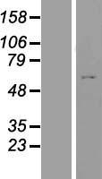 Western blot validation of overexpression lysate (Cat# LY403881) using anti-DDK antibody (Cat# TA50011-100). Left: Cell lysates from un-transfected HEK293T cells; Right: Cell lysates from HEK293T cells transfected with RC218578 using transfection reagent MegaTran 2.0 (Cat# TT210002).