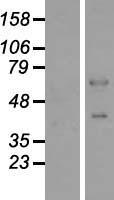 Western blot validation of overexpression lysate (Cat# LY407909) using anti-DDK antibody (Cat# TA50011-100). Left: Cell lysates from un-transfected HEK293T cells; Right: Cell lysates from HEK293T cells transfected with RC219664 using transfection reagent MegaTran 2.0 (Cat# TT210002).