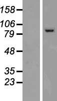 Western blot validation of overexpression lysate (Cat# LY410147) using anti-DDK antibody (Cat# TA50011-100). Left: Cell lysates from un-transfected HEK293T cells; Right: Cell lysates from HEK293T cells transfected with RC213121 using transfection reagent MegaTran 2.0 (Cat# TT210002).