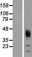 Western blot validation of overexpression lysate (Cat# LY405630) using anti-DDK antibody (Cat# TA50011-100). Left: Cell lysates from un-transfected HEK293T cells; Right: Cell lysates from HEK293T cells transfected with RC215739 using transfection reagent MegaTran 2.0 (Cat# TT210002).