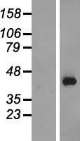 Western blot validation of overexpression lysate (Cat# LY415660) using anti-DDK antibody (Cat# TA50011-100). Left: Cell lysates from un-transfected HEK293T cells; Right: Cell lysates from HEK293T cells transfected with RC213822 using transfection reagent MegaTran 2.0 (Cat# TT210002).