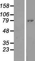Western blot validation of overexpression lysate (Cat# LY410897) using anti-DDK antibody (Cat# TA50011-100). Left: Cell lysates from un-transfected HEK293T cells; Right: Cell lysates from HEK293T cells transfected with RC213062 using transfection reagent MegaTran 2.0 (Cat# TT210002).