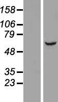 Western blot validation of overexpression lysate (Cat# LY411124) using anti-DDK antibody (Cat# TA50011-100). Left: Cell lysates from un-transfected HEK293T cells; Right: Cell lysates from HEK293T cells transfected with RC222703 using transfection reagent MegaTran 2.0 (Cat# TT210002).