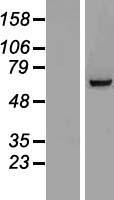 Western blot validation of overexpression lysate (Cat# LY410617) using anti-DDK antibody (Cat# TA50011-100). Left: Cell lysates from un-transfected HEK293T cells; Right: Cell lysates from HEK293T cells transfected with RC215809 using transfection reagent MegaTran 2.0 (Cat# TT210002).