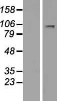 Western blot validation of overexpression lysate (Cat# LY408762) using anti-DDK antibody (Cat# TA50011-100). Left: Cell lysates from un-transfected HEK293T cells; Right: Cell lysates from HEK293T cells transfected with RC223788 using transfection reagent MegaTran 2.0 (Cat# TT210002).
